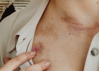 The Checklist Is a Trap: Why I Abandoned Standard Personal Injury Advice and How the “Claim Advocate” Framework Wins